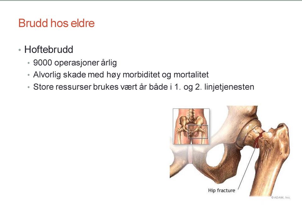 høy morbiditet og mortalitet Store