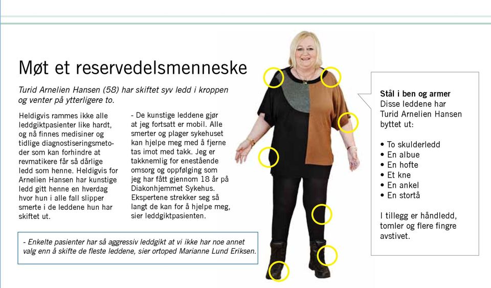 Heldigvis for Arnelien Hansen har kunstige ledd gitt henne en hverdag hvor hun i alle fall slipper smerte i de leddene hun har skiftet ut. - De kunstige leddene gjør at jeg fortsatt er mobil.