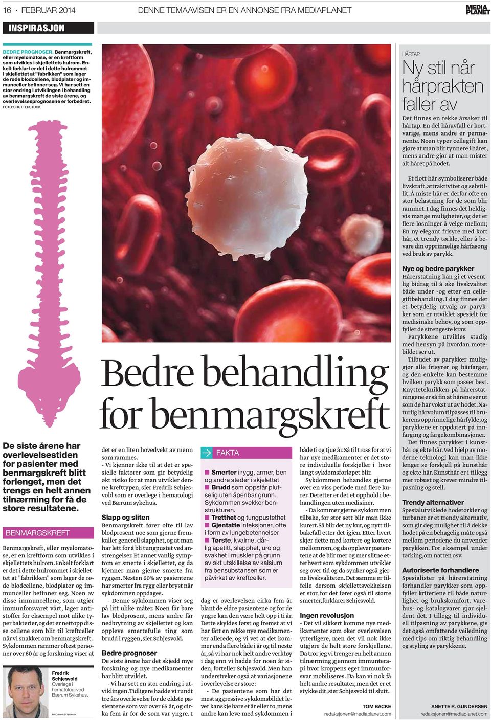 Vi har sett en stor endring i utviklingen i behandling av benmargskreft de siste årene, og overlevelsesprognosene er forbedret.