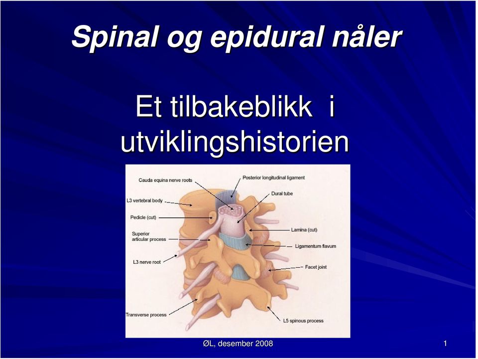 tilbakeblikk i