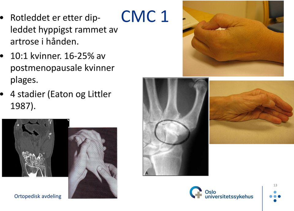 16-25% av postmenopausale kvinner plages.