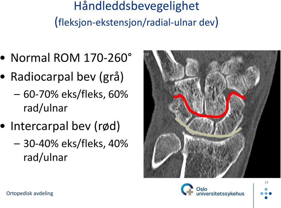 ROM 170-260 Radiocarpal bev (grå) 60-70%