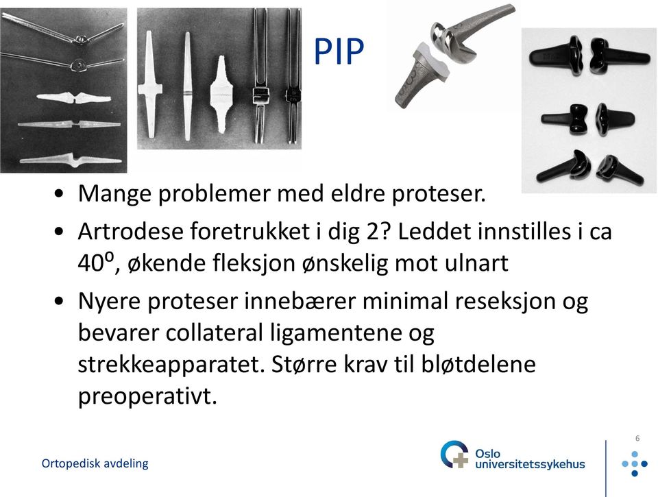 Leddet innstilles i ca 40⁰, økende fleksjon ønskelig mot ulnart