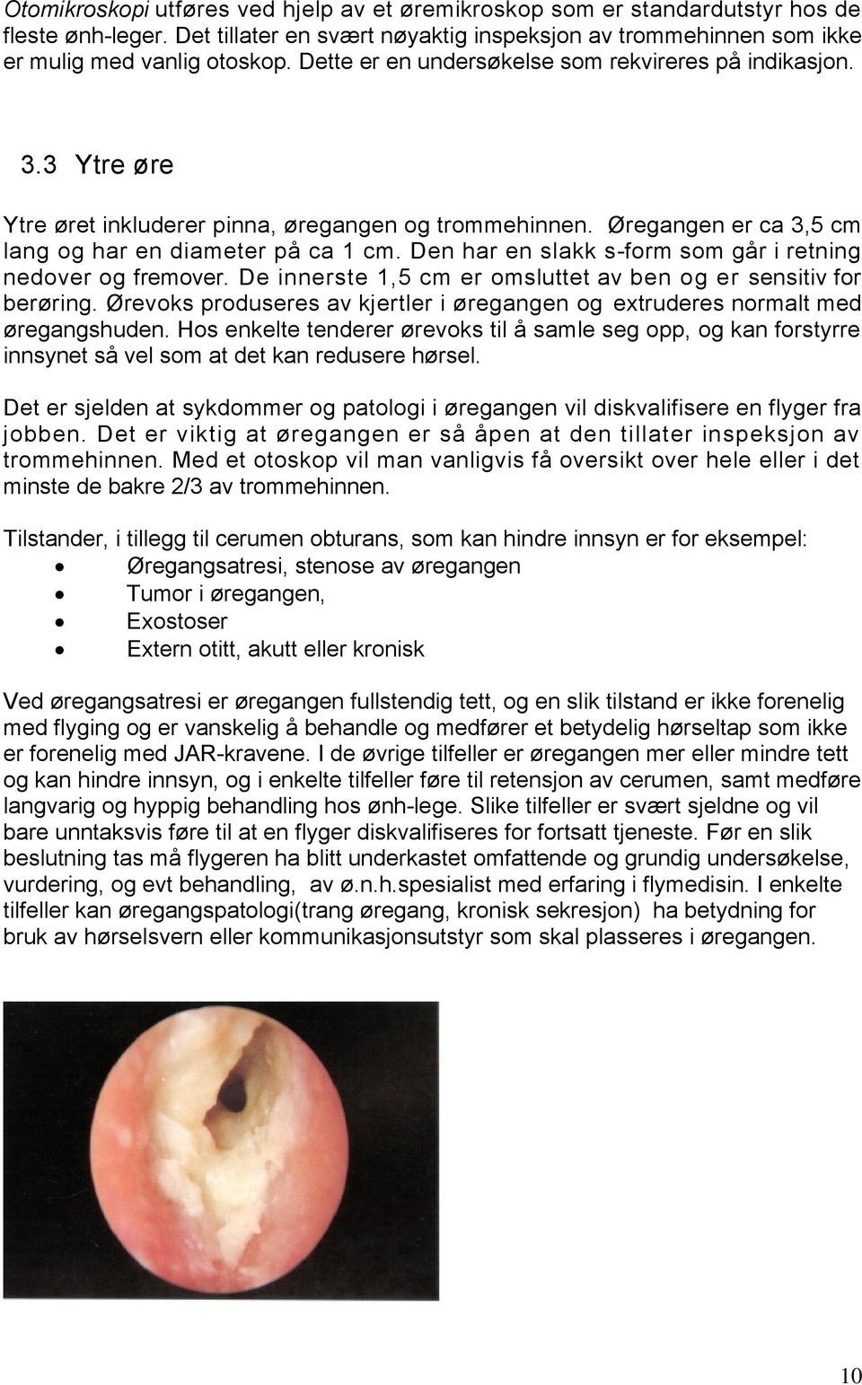 Den har en slakk s-form som går i retning nedover og fremover. De innerste 1,5 cm er omsluttet av ben og er sensitiv for berøring.