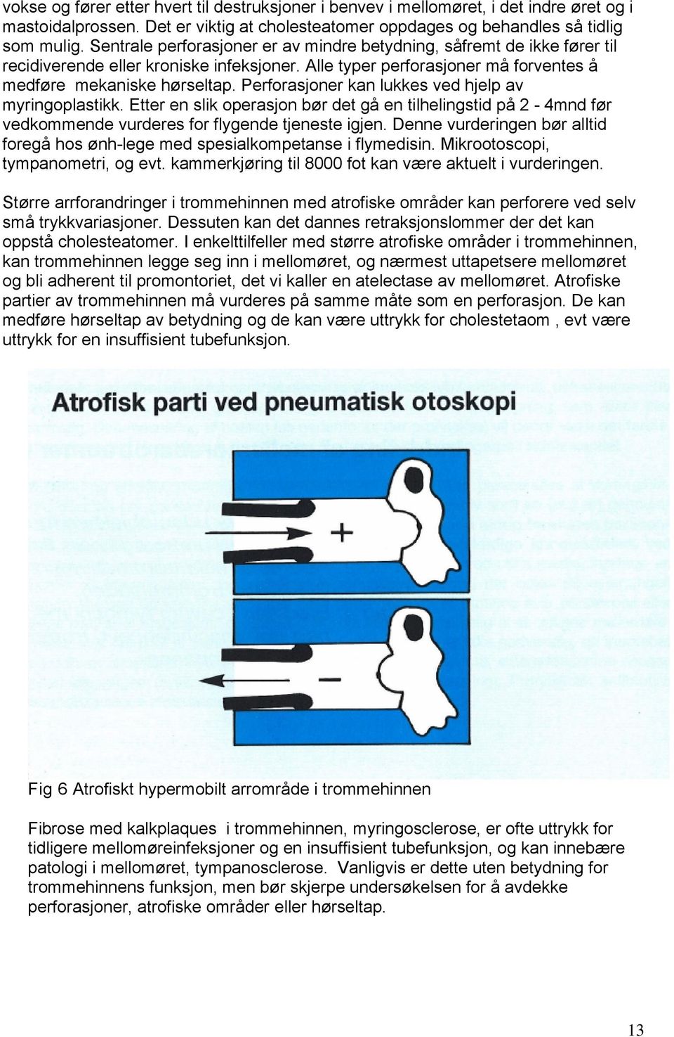 Perforasjoner kan lukkes ved hjelp av myringoplastikk. Etter en slik operasjon bør det gå en tilhelingstid på 2-4mnd før vedkommende vurderes for flygende tjeneste igjen.