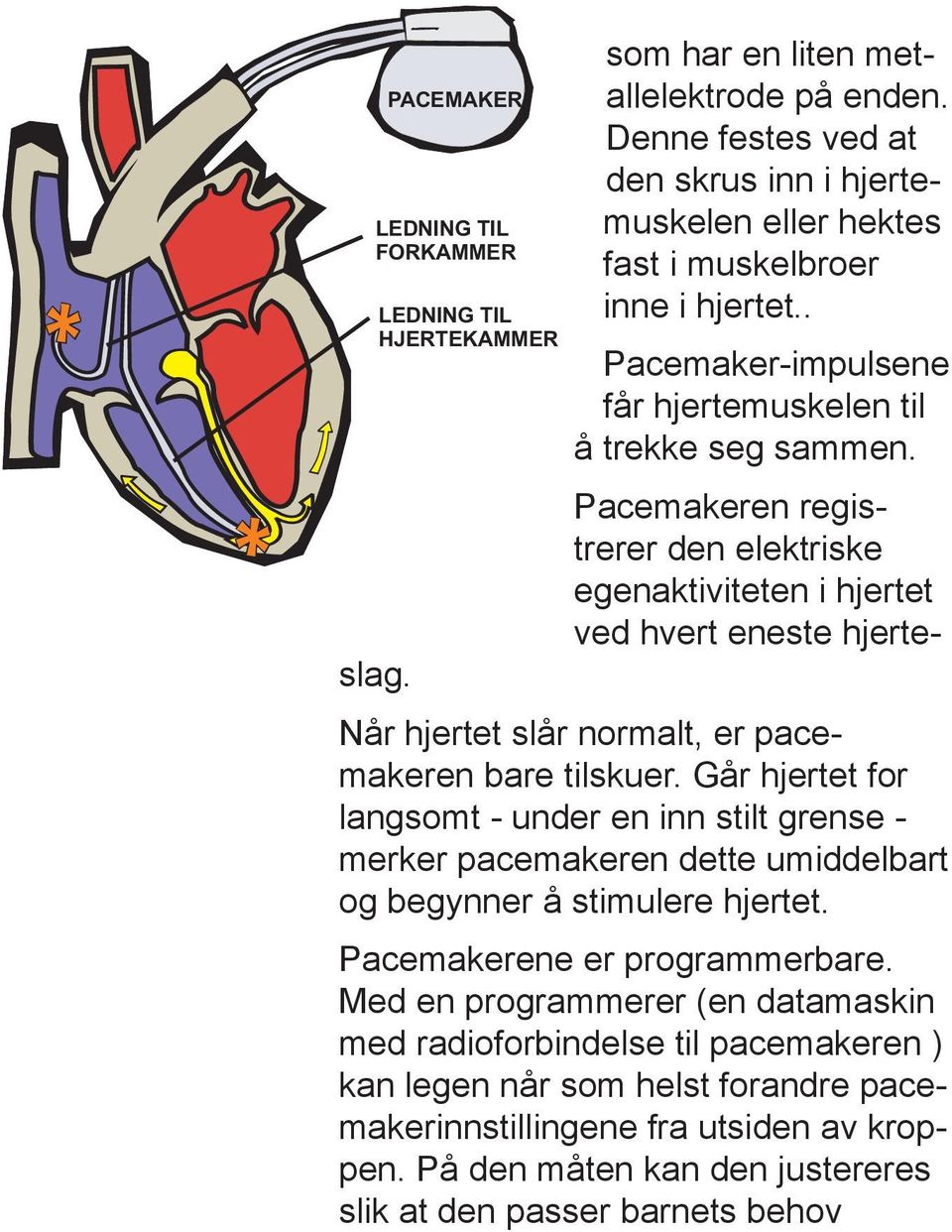 Pacemakeren registrerer den elektriske egenaktiviteten i hjertet ved hvert eneste hjerte Når hjertet slår normalt, er pacemakeren bare tilskuer.