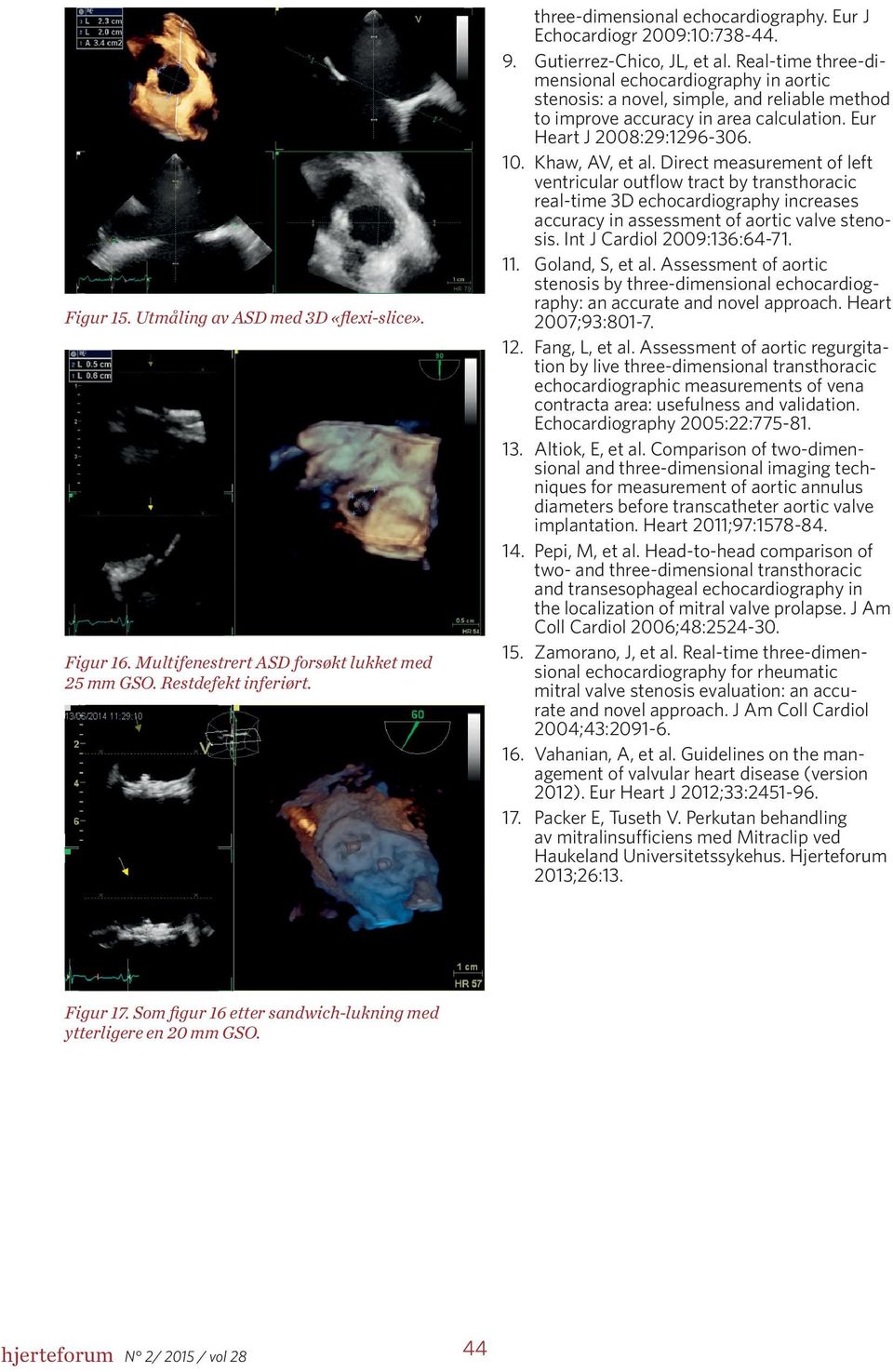 Eur Heart J 2008:29:1296-306. 10. Khaw, AV, et al.