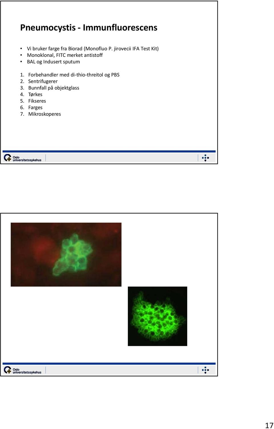 Indusert sputum 1. Forbehandler med di thio threitol og PBS 2.