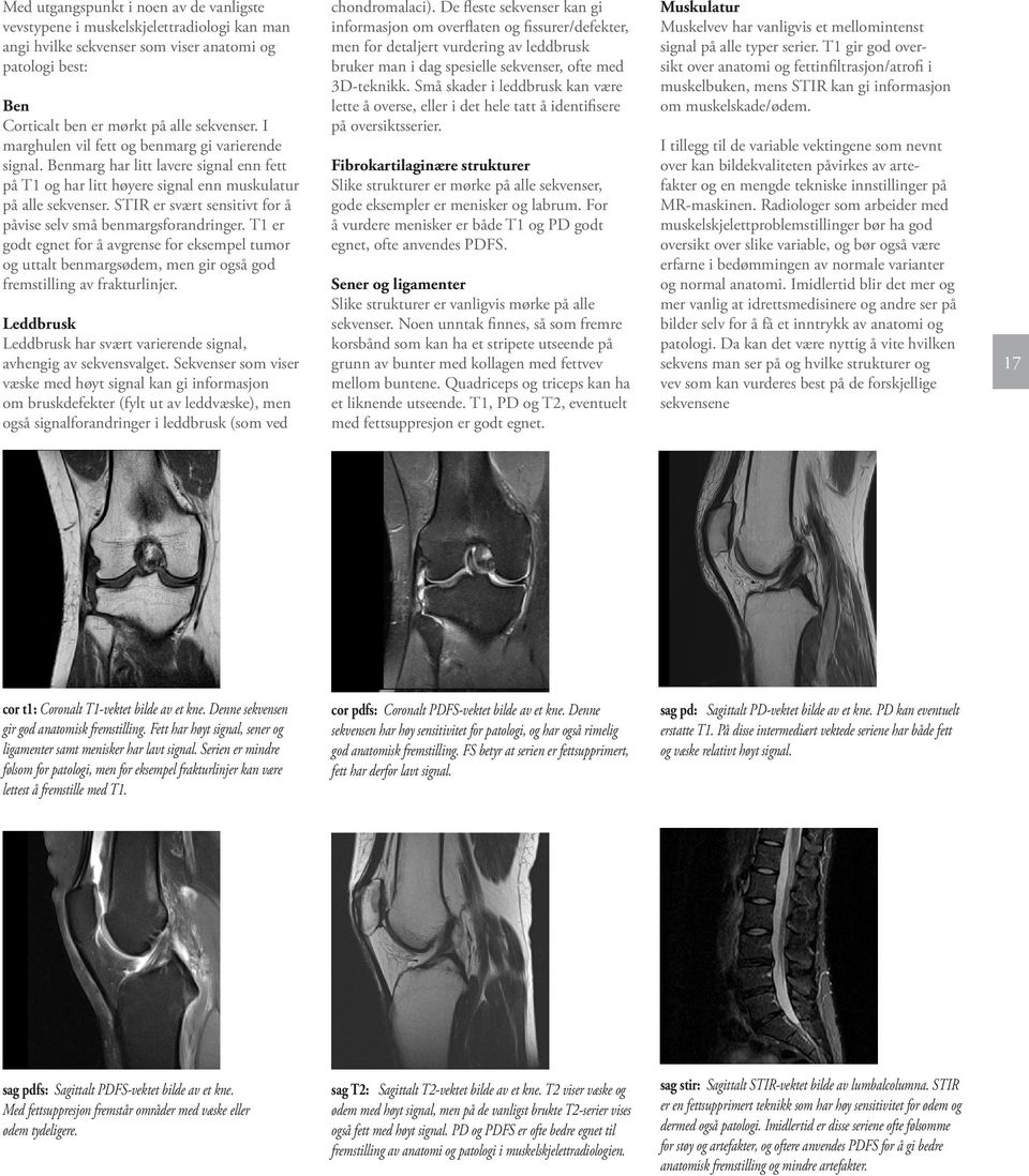 STIR er svært sensitivt for å påvise selv små benmargsforandringer. T1 er godt egnet for å avgrense for eksempel tumor og uttalt benmargsødem, men gir også god fremstilling av frakturlinjer.