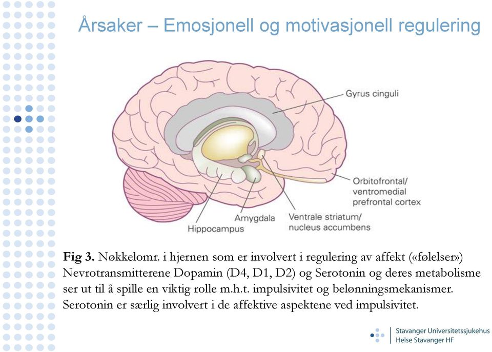 Dopamin (D4, D1, D2) og Serotonin og deres metabolisme ser ut til å spille en viktig