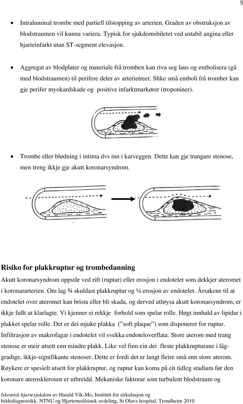 Aggregat av blodplater og materiale frå tromben kan riva seg laus og embolisera (gå med blodstraumen) til perifere deler av arterietreet.