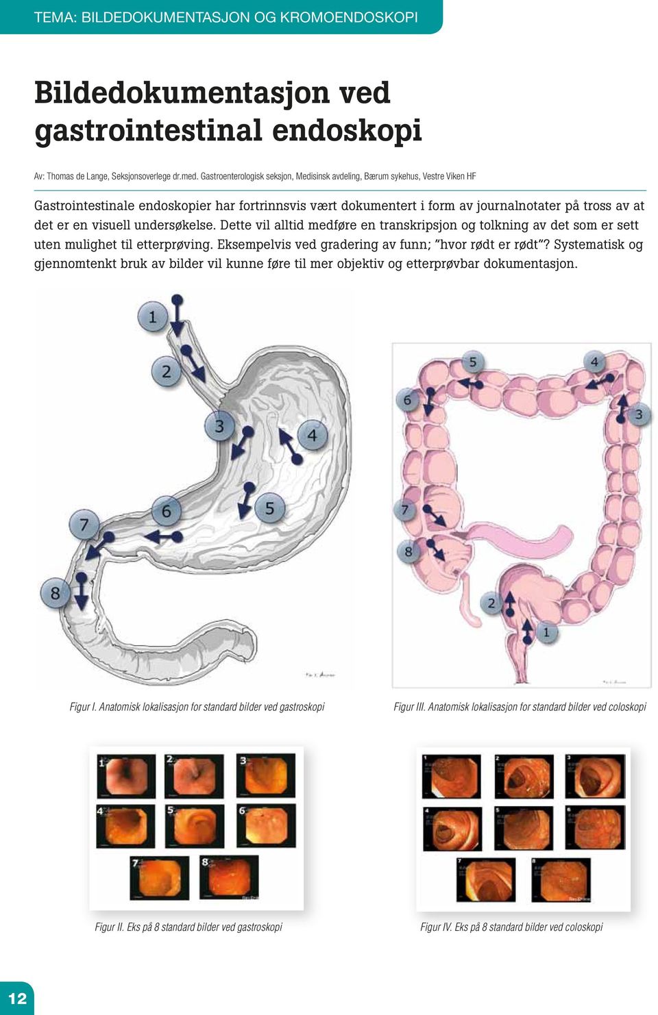 visuell undersøkelse. Dette vil alltid medføre en transkripsjon og tolkning av det som er sett uten mulighet til etterprøving. Eksempelvis ved gradering av funn; hvor rødt er rødt?