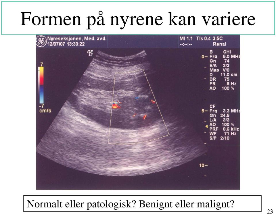 eller patologisk?