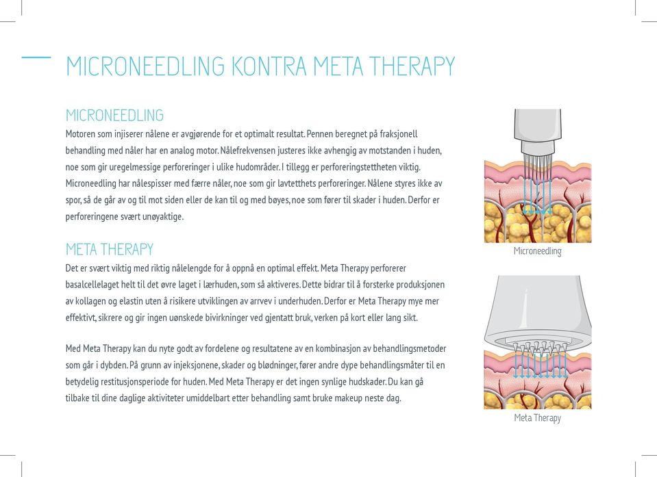 Microneedling har nålespisser med færre nåler, noe som gir lavtetthets perforeringer.