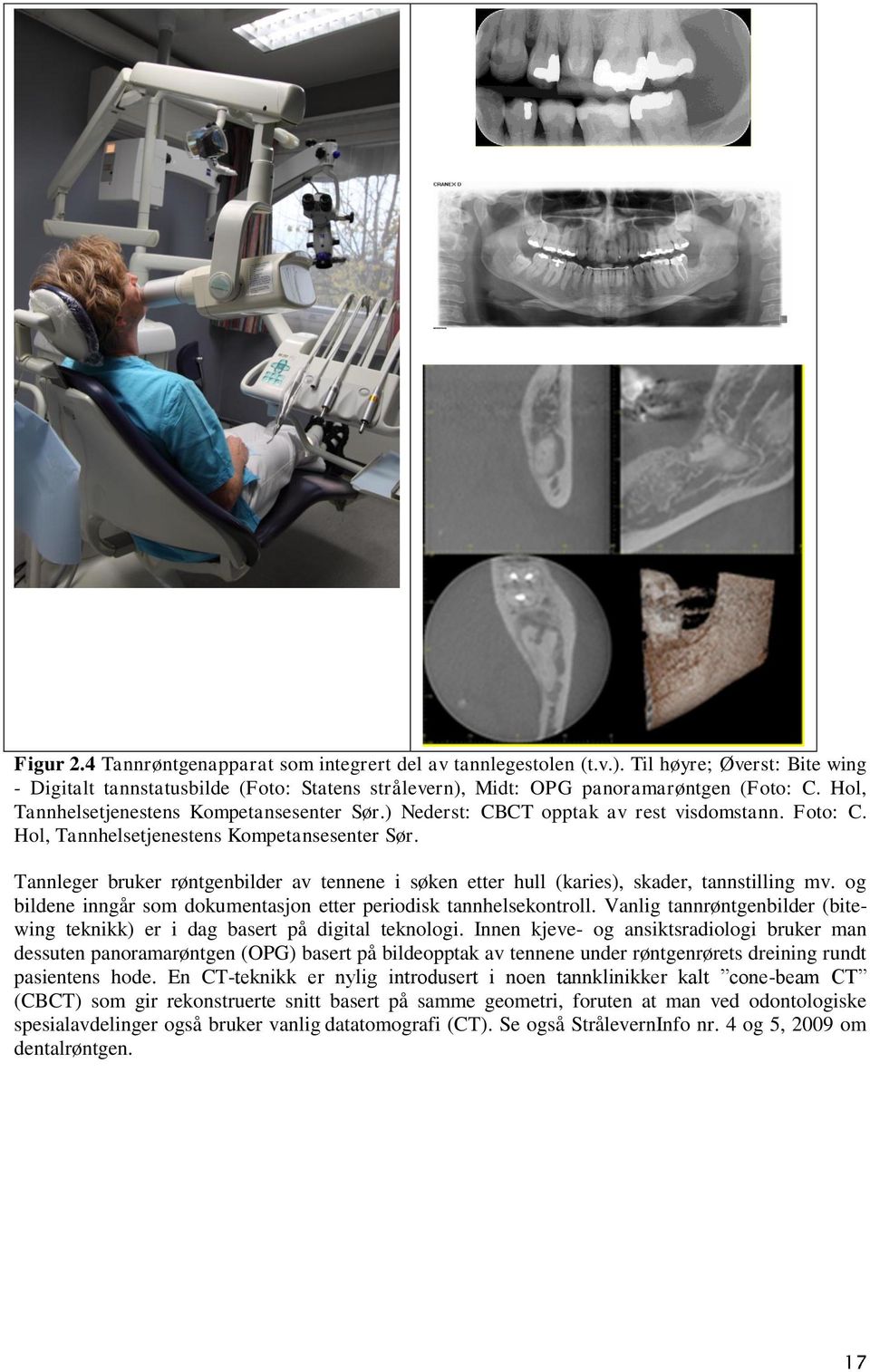 Tannleger bruker røntgenbilder av tennene i søken etter hull (karies), skader, tannstilling mv. og bildene inngår som dokumentasjon etter periodisk tannhelsekontroll.