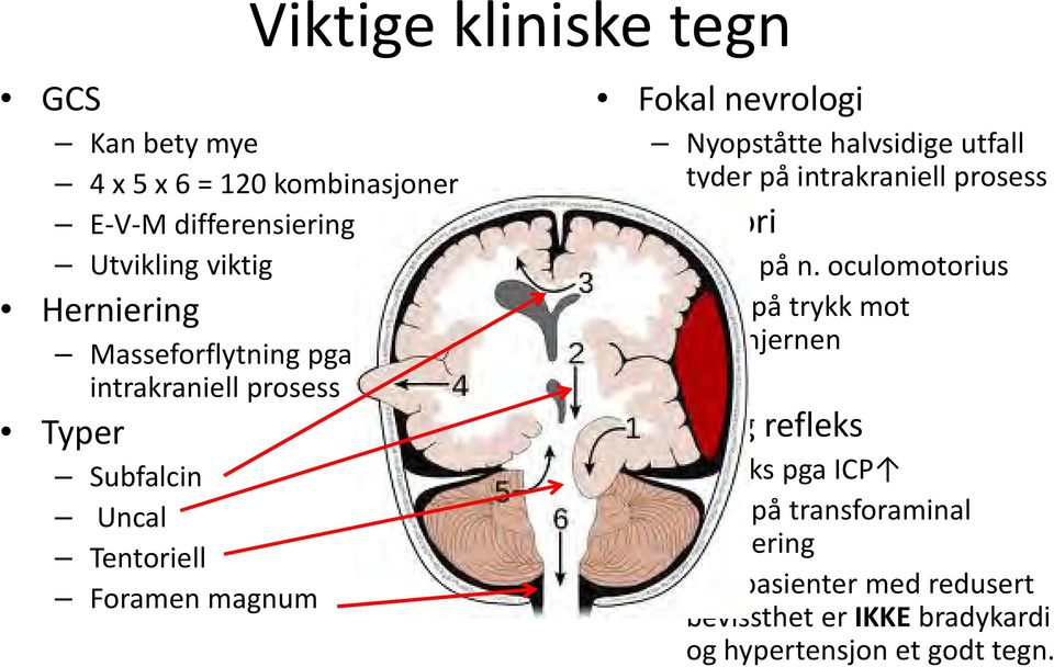 halvsidige utfall tyder på intrakraniell prosess Anisokori Press på n.