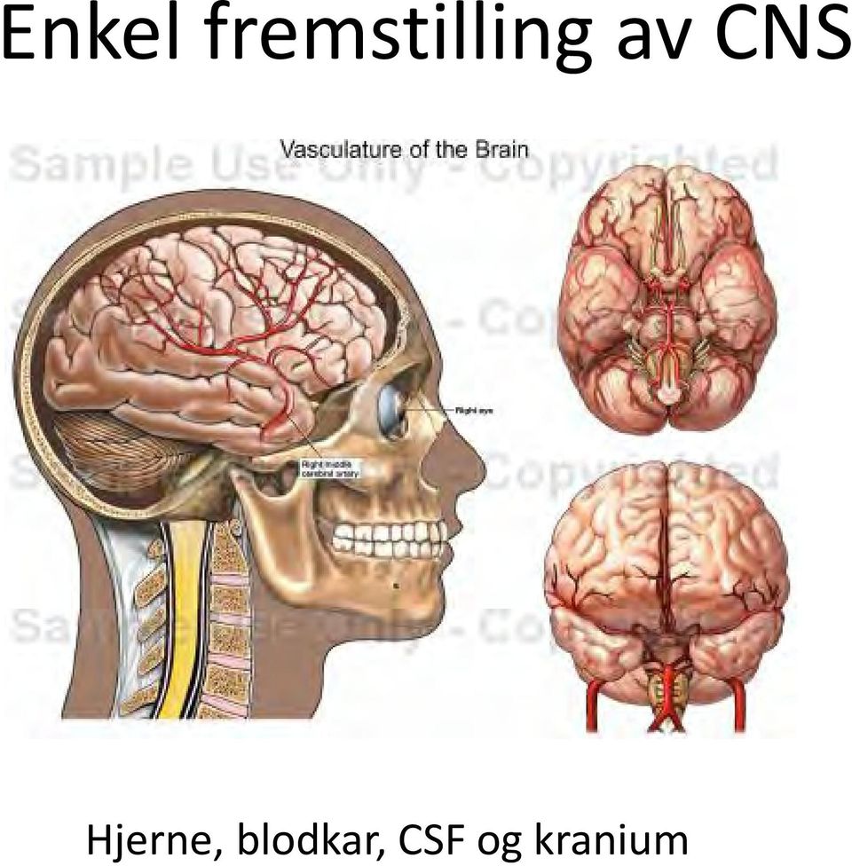 av CNS Hjerne,