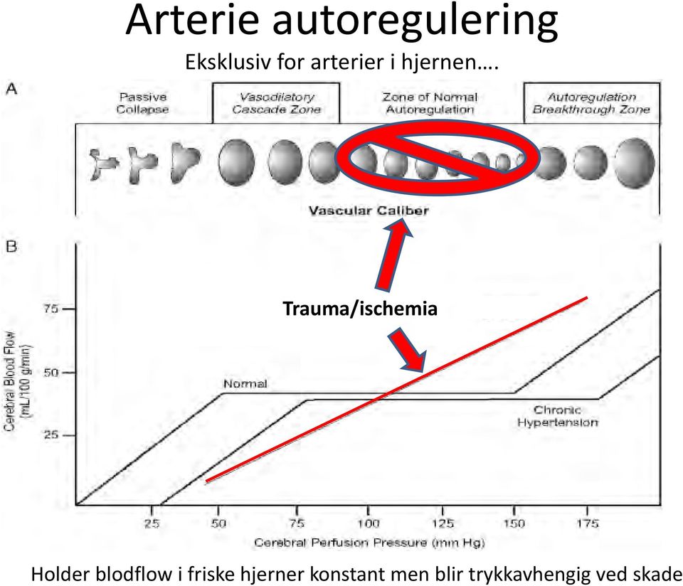 Trauma/ischemia Holder blodflow i