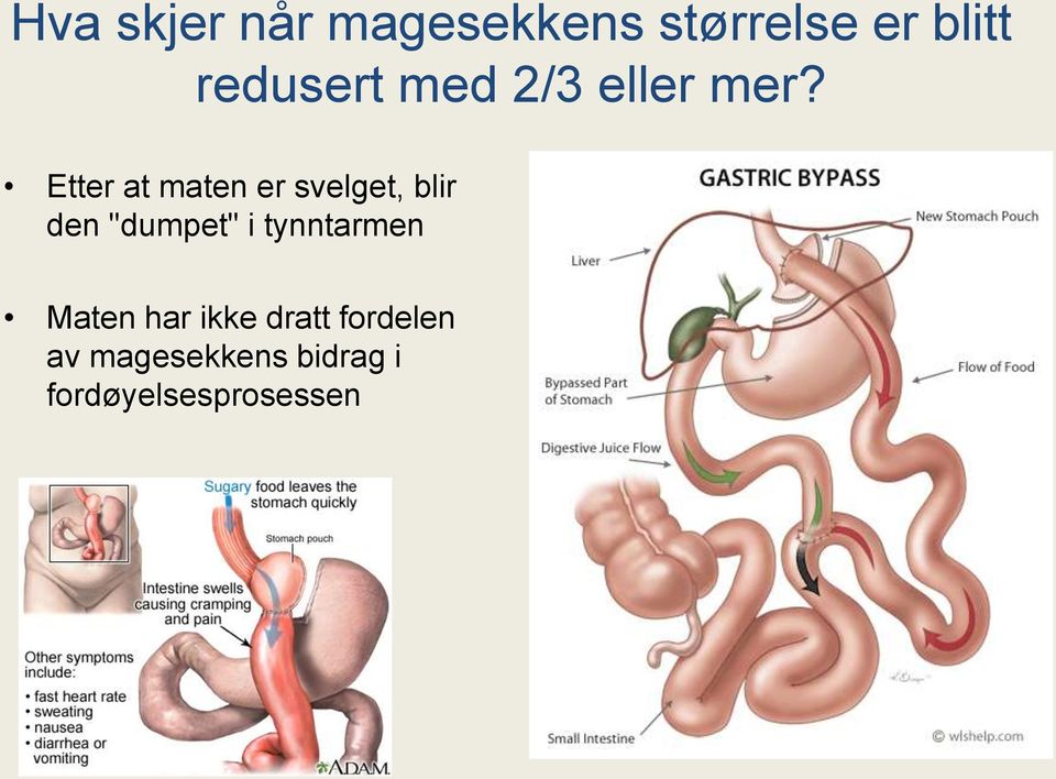 Etter at maten er svelget, blir den "dumpet" i