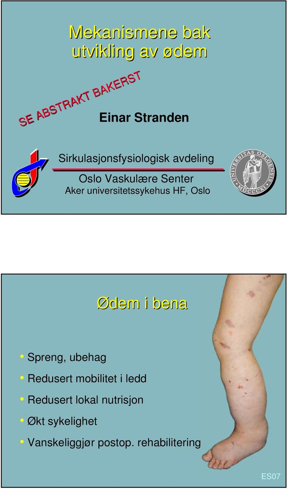 universitetssykehus HF, Oslo Ødem i bena Spreng, ubehag Redusert