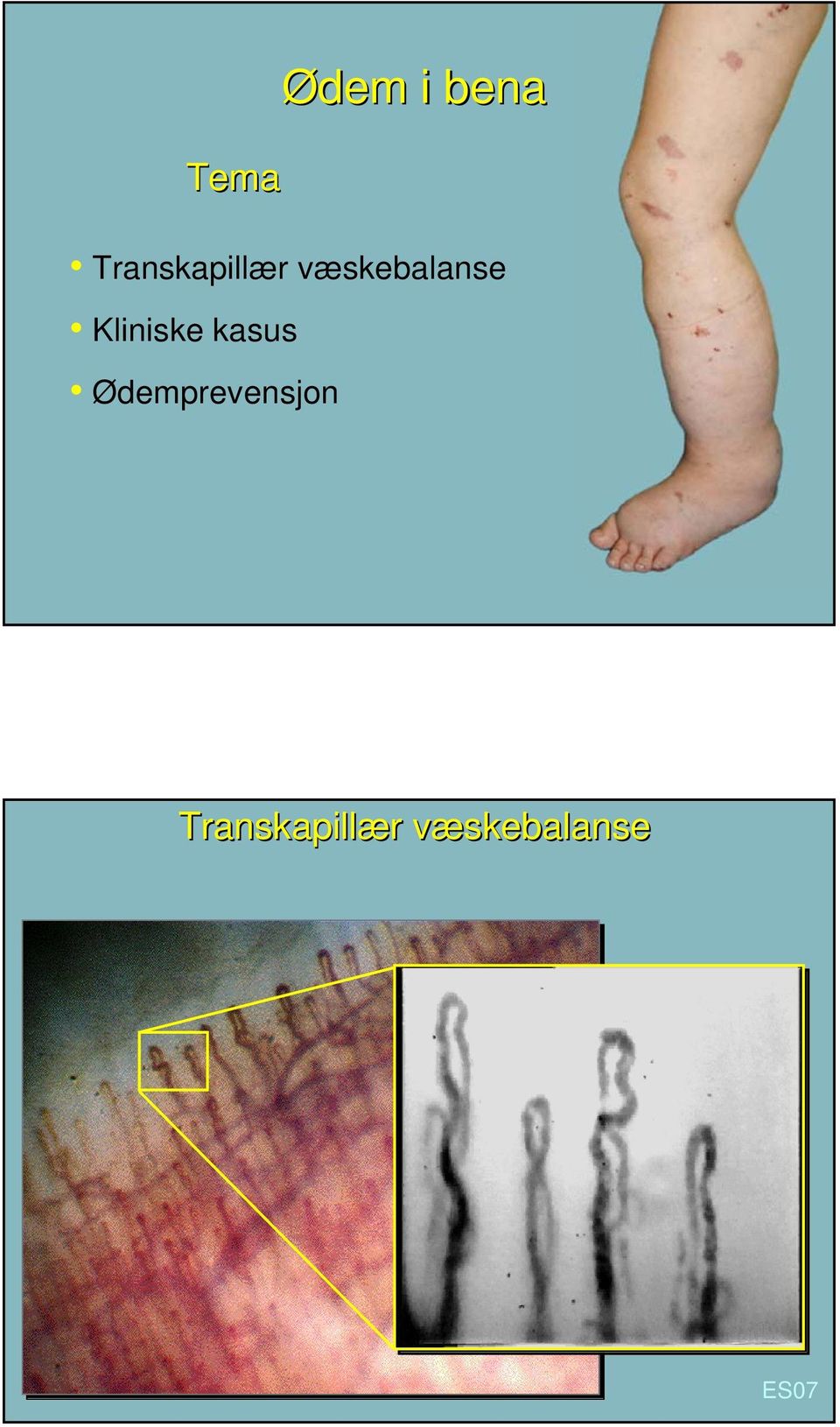 væskebalanse Kliniske