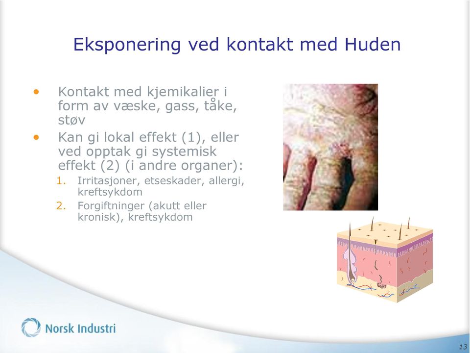 systemisk effekt (2) (i andre organer): 1.