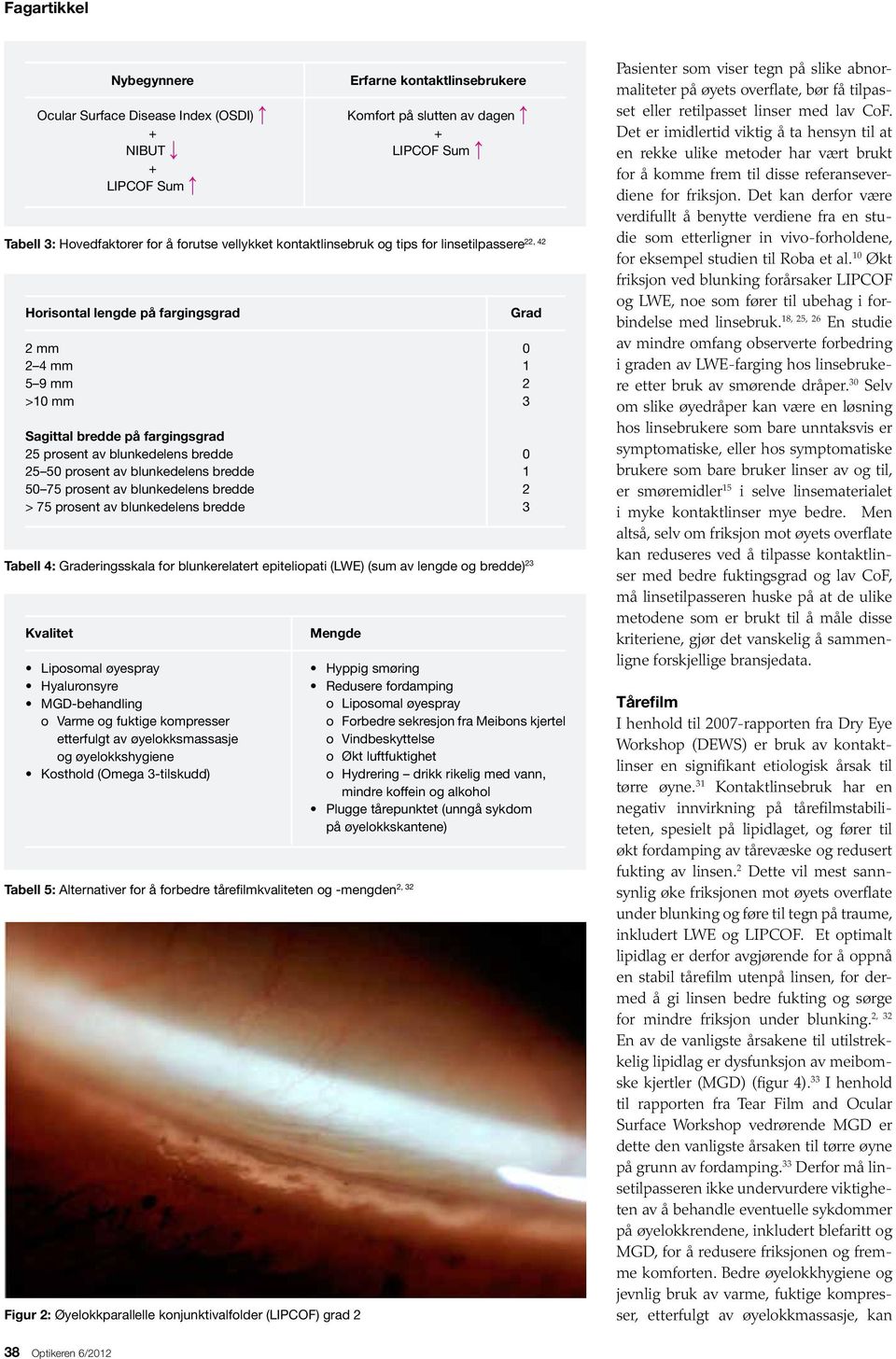 og -mengden 38 Optikeren 6/22 Nybegynnere Ocular Surface Disease Index (OSDI) + NIBUT + LIPCOF Sum 22, 42 Tabell 3: Hovedfaktorer for å forutse vellykket kontaktlinsebruk og tips for linsetilpassere