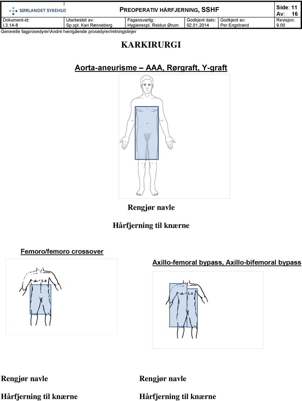 Femoro/femoro crossover Axillo-femoral bypass,