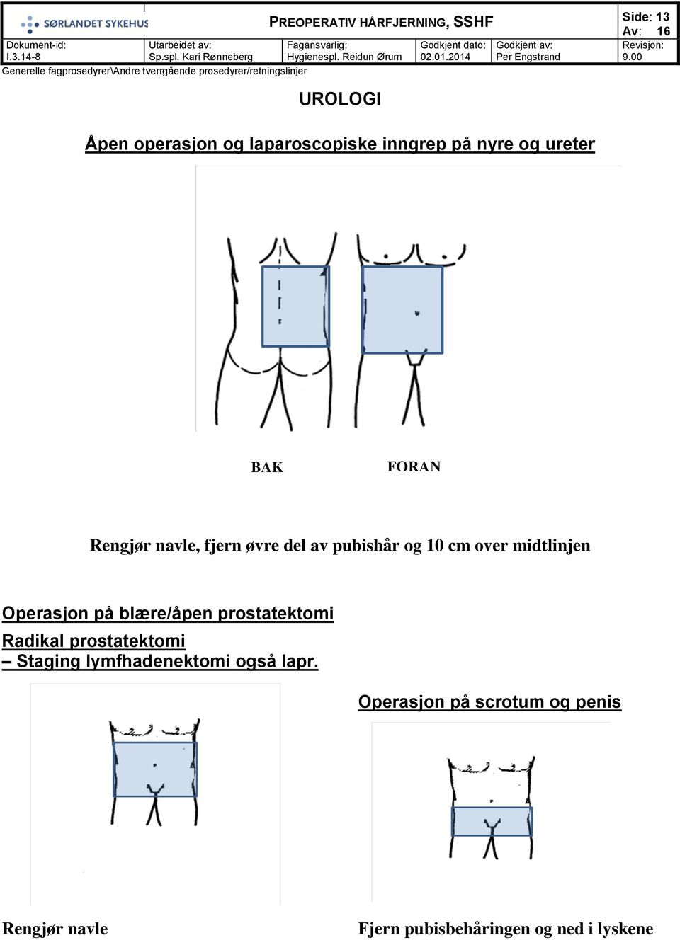 blære/åpen prostatektomi Radikal prostatektomi Staging lymfhadenektomi også