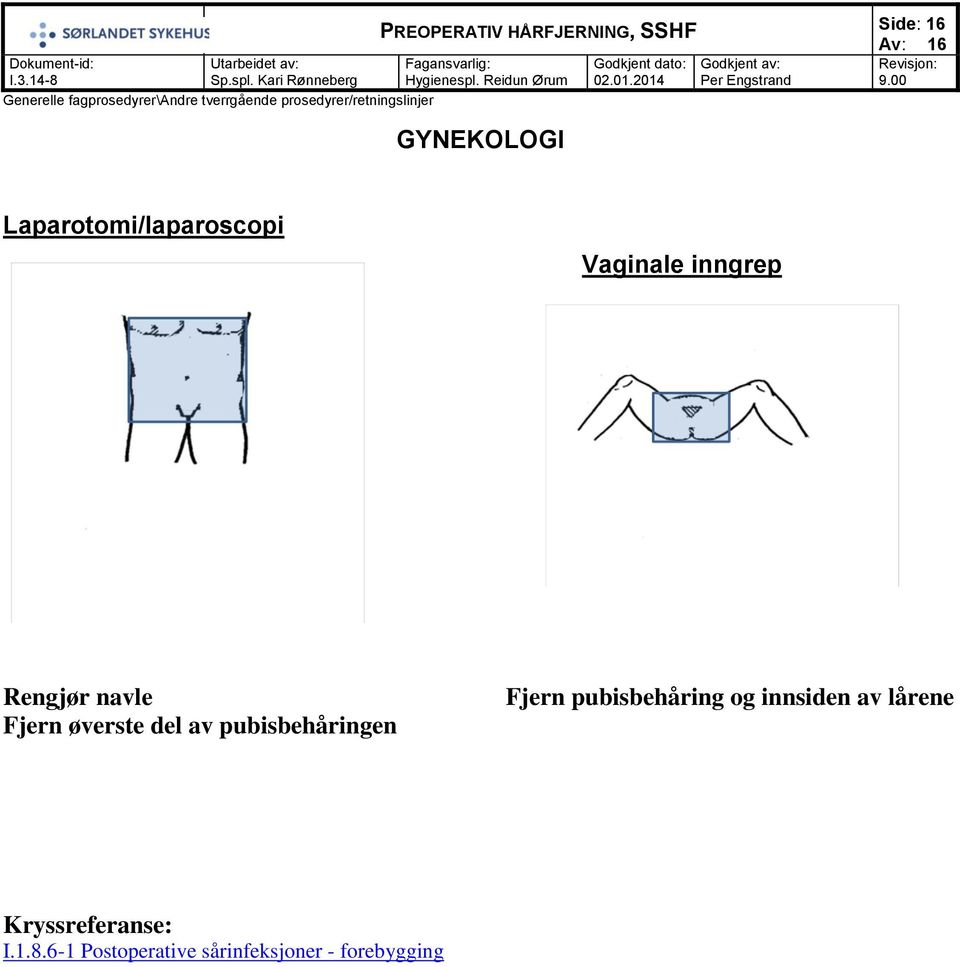 pubisbehåring og innsiden av lårene Kryssreferanse: