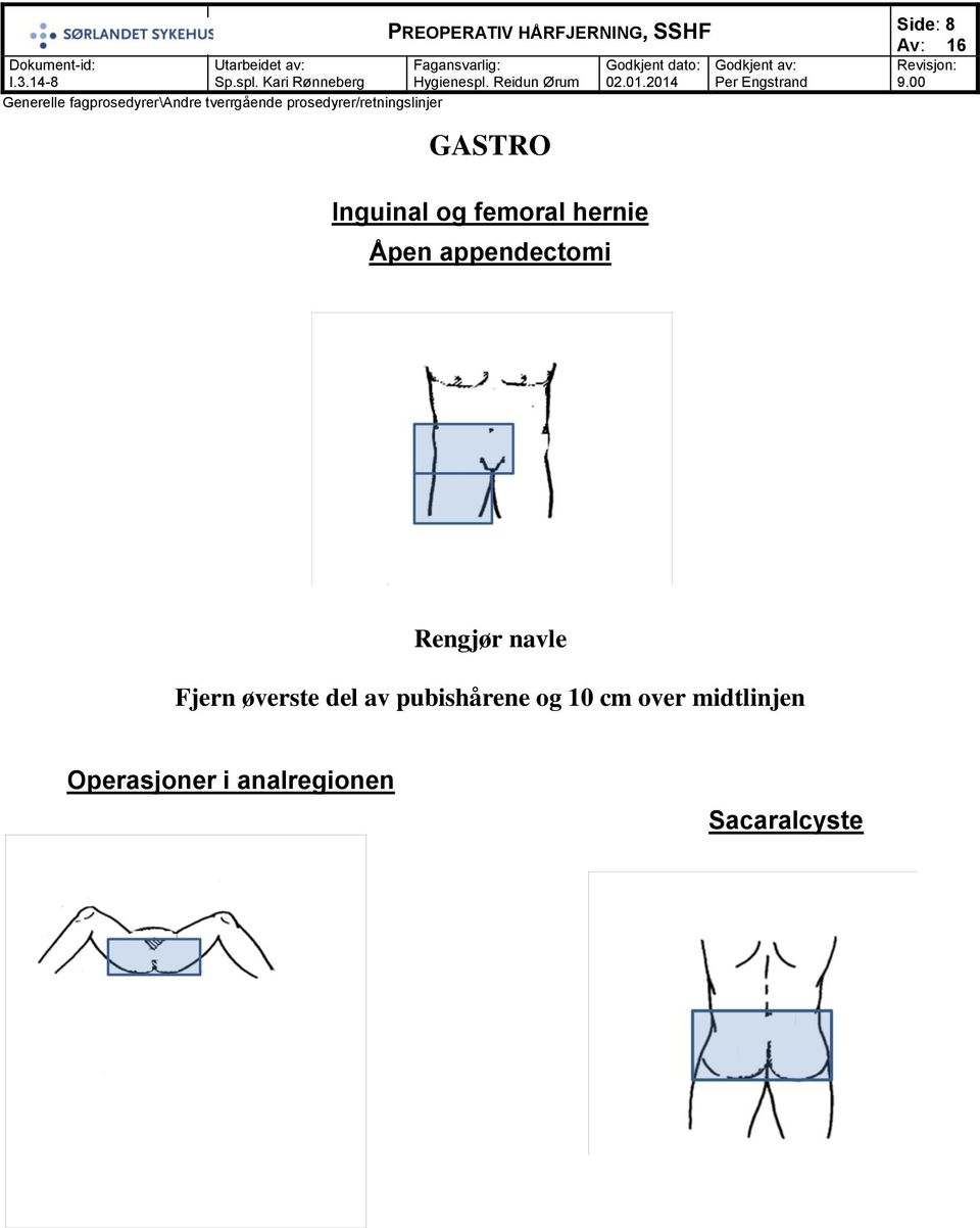 del av pubishårene og 10 cm over