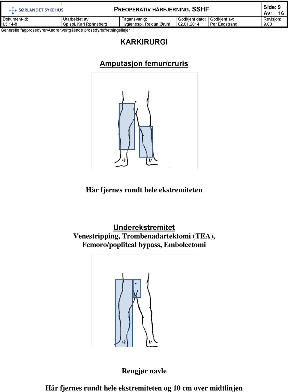 Trombenadartektomi (TEA), Femoro/popliteal bypass,