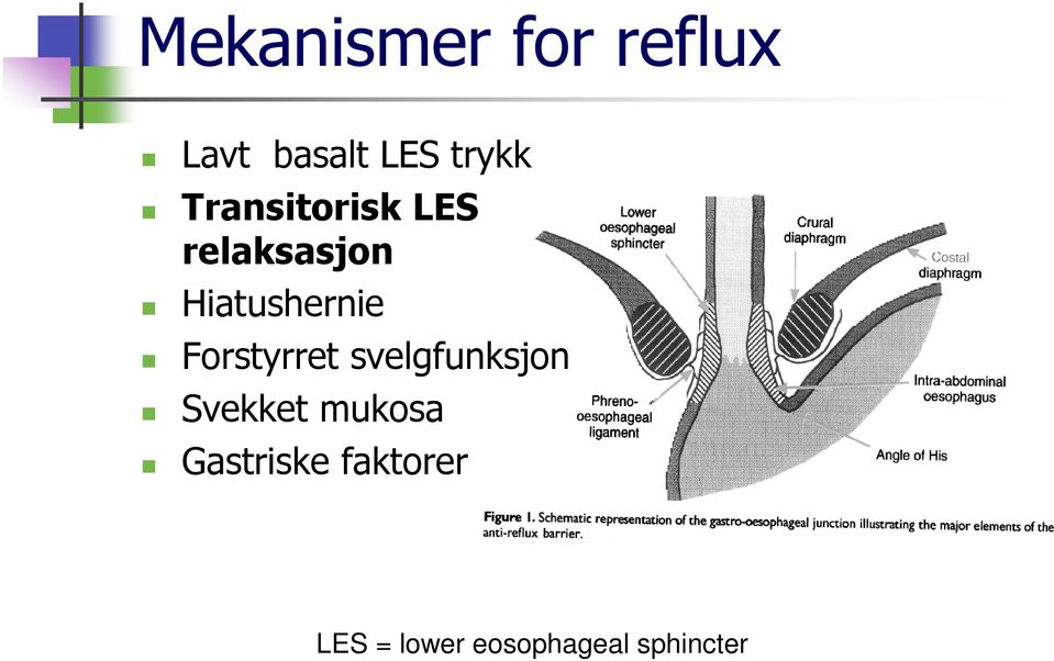 Forstyrret svelgfunksjon Svekket mukosa