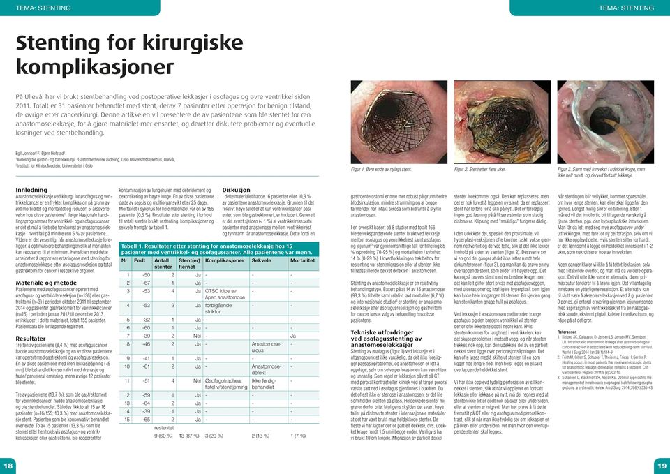 Denne artikkelen vil presentere de av pasientene som ble stentet for ren anastomoselekkasje, for å gjøre materialet mer ensartet, og deretter diskutere problemer og eventuelle løsninger ved