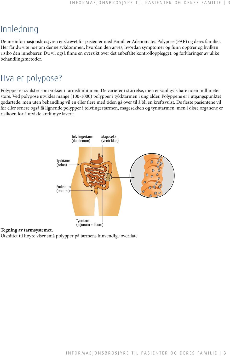 behandlingsmetoder Hva er polypose?