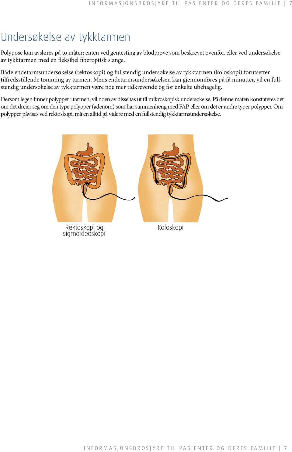 endetarmsundersøkelsen kan gjennomføres på få minutter, vil en fullstendig undersøkelse av tykktarmen være noe mer tidkrevende og for enkelte ubehagelig Dersom legen finner polypper i tarmen, vil