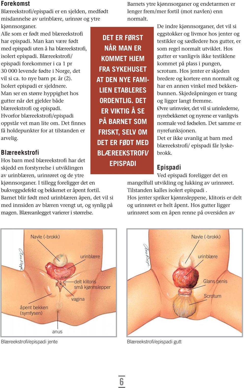 Isolert epispadi er sjeldnere. Man ser en større hyppighet hos gutter når det gjelder både blæreekstrofi og epispadi. Hvorfor blæreekstrofi/epispadi oppstår vet man lite om.