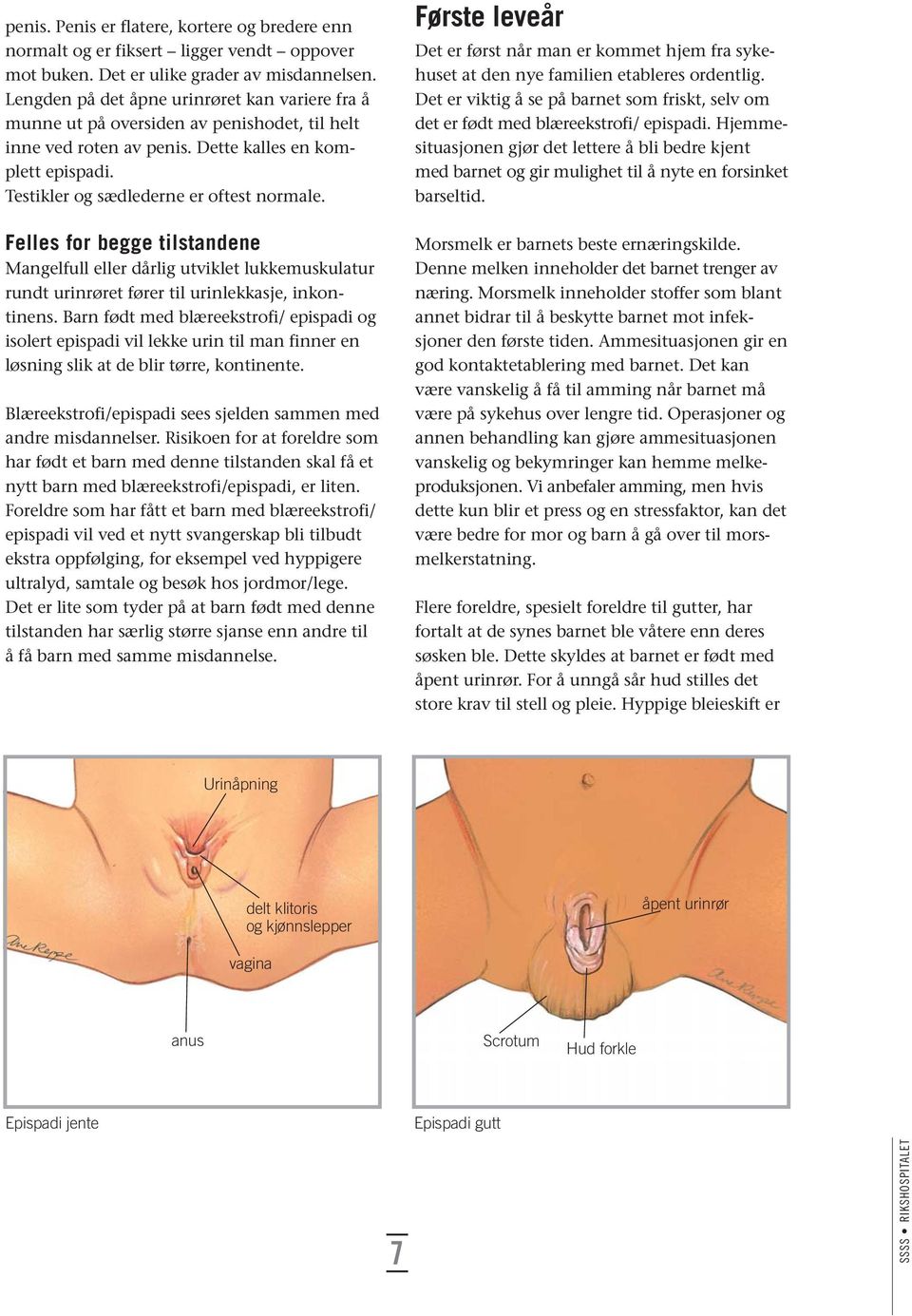 Felles for begge tilstandene Mangelfull eller dårlig utviklet lukkemuskulatur rundt urinrøret fører til urinlekkasje, inkon - tinens.