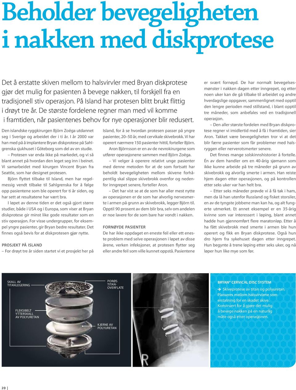 Den islandske ryggkirurgen Björn Zoëga utdannet seg i Sverige og arbeidet der i ti år. I år 2000 var han med på å implantere Bryan diskprotese på Sahlgrenska sjukhuset i Göteborg som del av en studie.