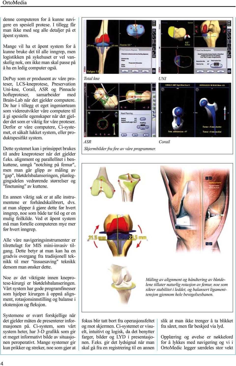 DePuy som er produsent av våre proteser, LCS-kneprotese, Preservation Uni-kne, Corail, ASR og Pinnacle hofteproteser, samarbeider med Brain-Lab når det gjelder computere.