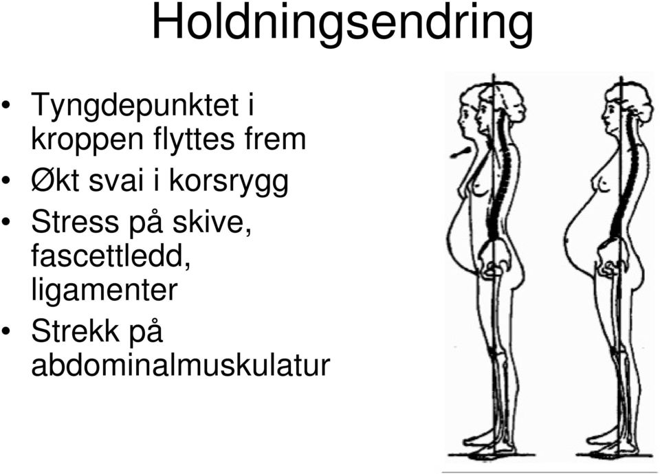 korsrygg Stress på skive,