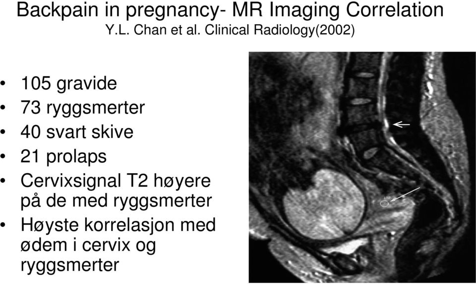 Clinical Radiology(2002) 105 gravide 73 ryggsmerter 40