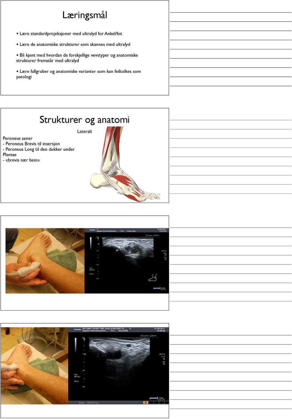 ultralyd Lære fallgruber og anatomiske varianter som kan feiltolkes som patologi Strukturer og anatomi