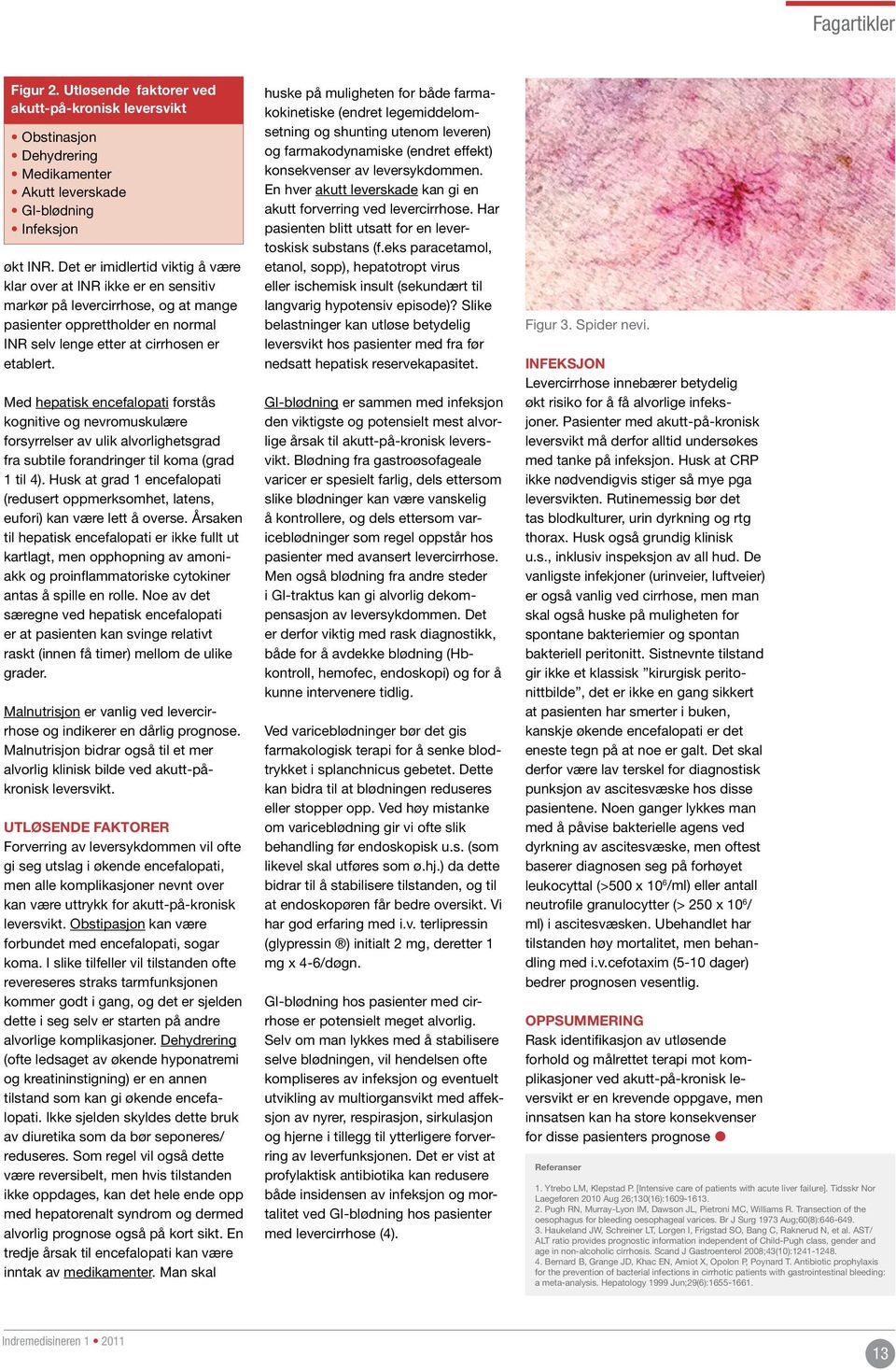 Med hepatisk encefalopati forstås kognitive og nevromuskulære forsyrrelser av ulik alvorlighetsgrad fra subtile forandringer til koma (grad 1 til 4).