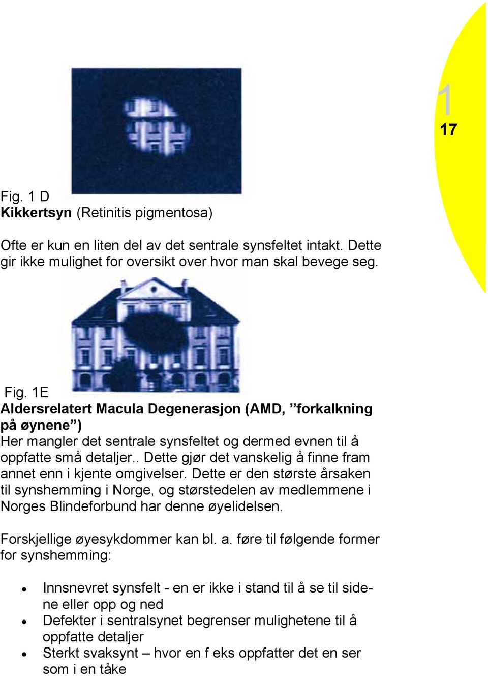 Forskjellige øyesykdommer kan bl. a.