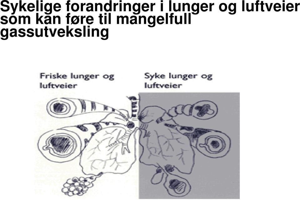 som kan føre til