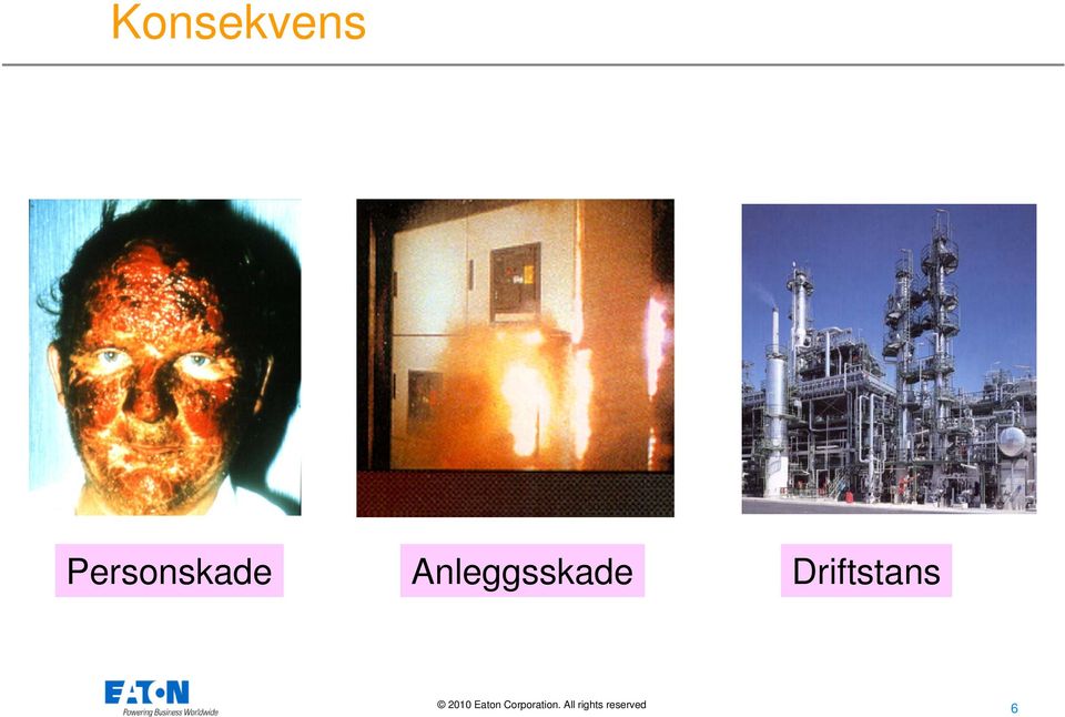 Anleggsskade