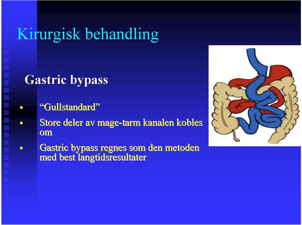 kanalen kobles om Gastric bypass regnes