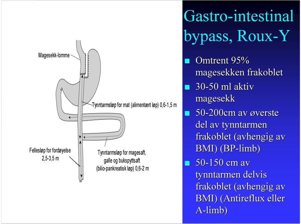 Omtrent 95% magesekken frakoblet 30-50 ml aktiv magesekk 50-200cm av øverste del av tynntarmen frakoblet