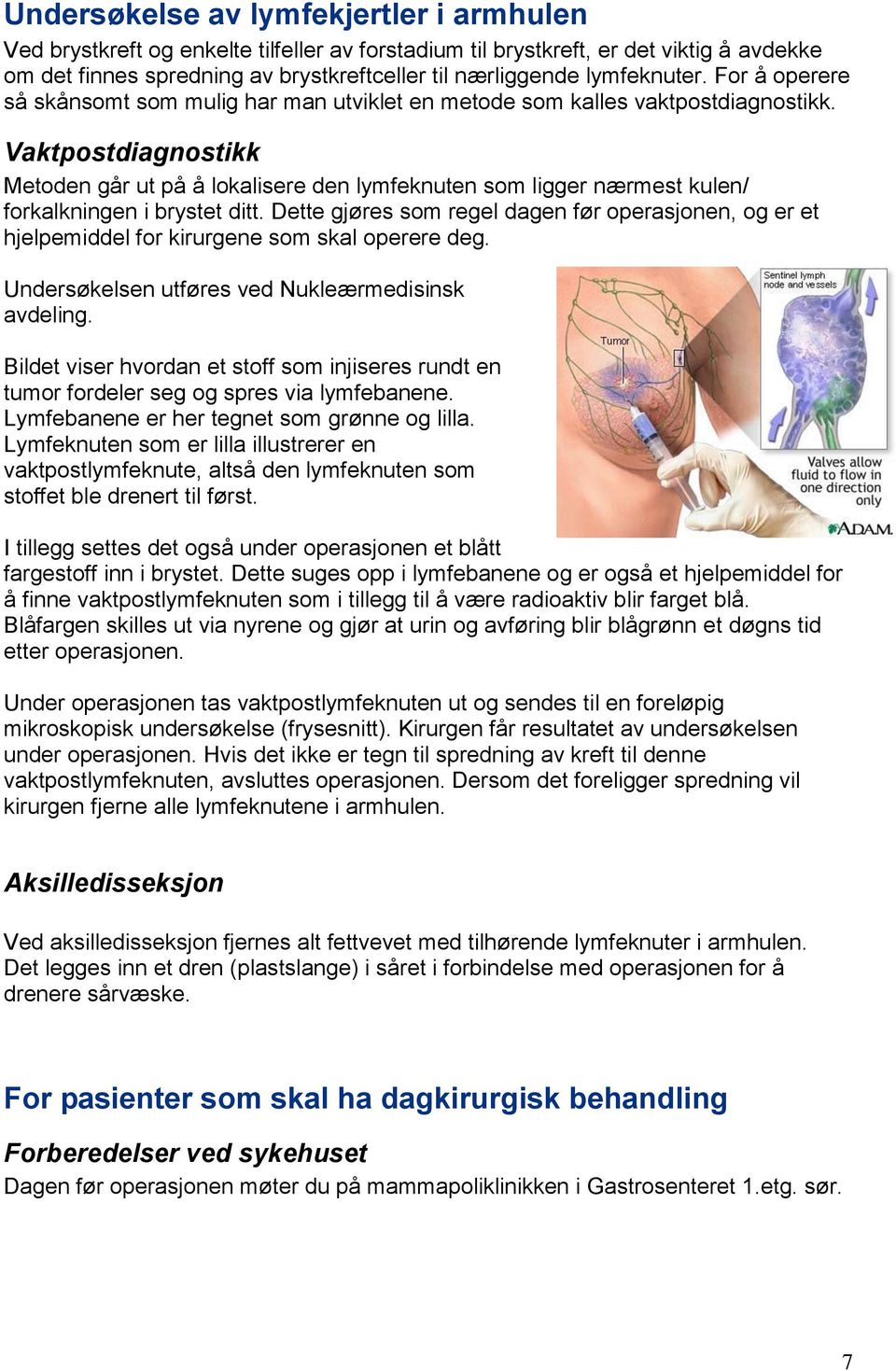 Vaktpostdiagnostikk Metoden går ut på å lokalisere den lymfeknuten som ligger nærmest kulen/ forkalkningen i brystet ditt.